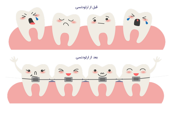 بیمار خوشحال پس از اتمام درمان ارتودنسی تخصصی و دستیابی به لبخندی زیبا، آماده برای مشاوره در کلینیک دکتر رئوف.