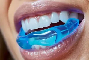مجموعه‌ای از محصولات توصیه شده برای مراقبت های بعد از لمینت دندان شامل مسواک نرم و نخ دندان مخصوص.