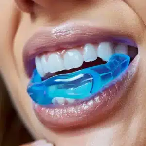 مجموعه‌ای از محصولات توصیه شده برای مراقبت های بعد از لمینت دندان شامل مسواک نرم و نخ دندان مخصوص.