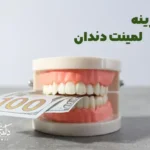 راهنمای کامل هزینه و قیمت هر واحد لمینت دندان سرامیکی در کلینیک دکتر آریا رئوف در تبریز.