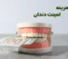 راهنمای کامل هزینه و قیمت هر واحد لمینت دندان سرامیکی در کلینیک دکتر آریا رئوف در تبریز.