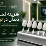 راهنمای کامل هزینه لمینت دندان در تبریز و قیمت ونیر سرامیکی باکیفیت سال ۱۴۰۵