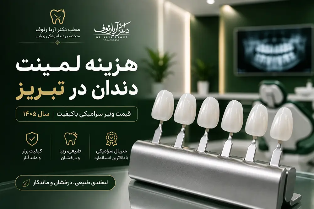 راهنمای کامل هزینه لمینت دندان در تبریز و قیمت ونیر سرامیکی باکیفیت سال ۱۴۰۵