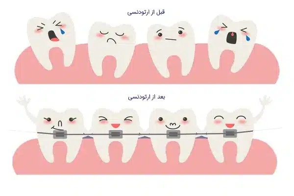 بیمار خوشحال پس از اتمام درمان ارتودنسی تخصصی و دستیابی به لبخندی زیبا، آماده برای مشاوره در کلینیک دکتر رئوف.