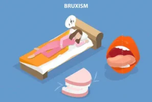روش‌های درمان دندان قروچه (براکسیسم) در تبریز با استفاده از نایت گارد تخصصی