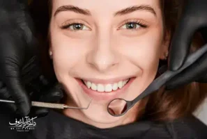 راهنمای کامل مراقبت صحیح و افزایش ماندگاری کامپوزیت دندان