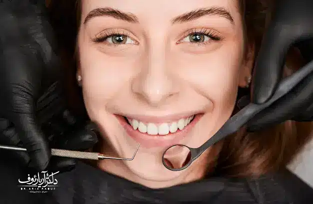 راهنمای کامل مراقبت صحیح و افزایش ماندگاری کامپوزیت دندان