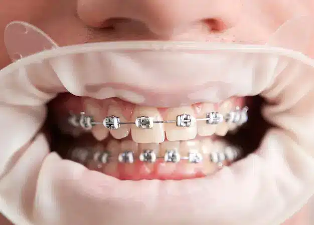 اینفوگرافیک عوامل موثر بر هزینه و قیمت ارتودنسی دندان در تبریز