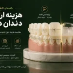 راهنمای کامل هزینه ارتودنسی دندان در تبریز و شرایط پرداخت اقساطی