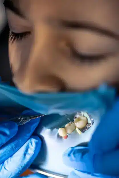 فرآیند پولیش کامپوزیت دندان در تبریز برای از بین بردن لکه‌ها و افزایش ماندگاری