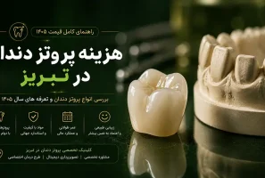 راهنمای کامل هزینه انواع پروتز دندان در تبریز شامل قیمت روکش، دندان مصنوعی و بریج