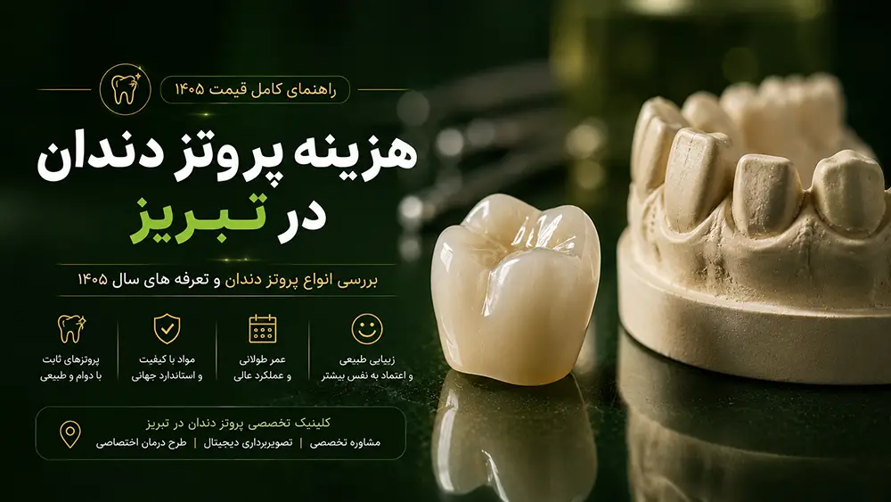راهنمای کامل هزینه انواع پروتز دندان در تبریز شامل قیمت روکش، دندان مصنوعی و بریج