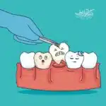 اینفوگرافیک عواقب جابجا شدن و کج شدن دندانها پس از کشیدن و پر نکردن جای خالی دندان