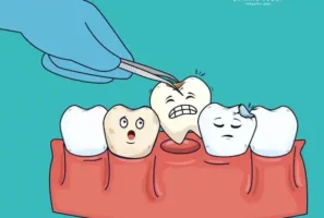 اینفوگرافیک عواقب جابجا شدن و کج شدن دندان‌ها پس از کشیدن و پر نکردن جای خالی دندان