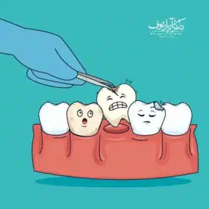 اینفوگرافیک عواقب جابجا شدن و کج شدن دندان‌ها پس از کشیدن و پر نکردن جای خالی دندان