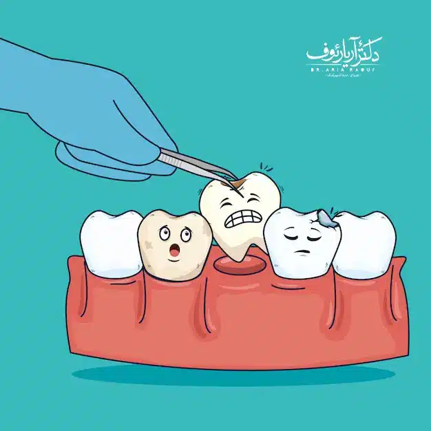 اینفوگرافیک عواقب جابجا شدن و کج شدن دندان‌ها پس از کشیدن و پر نکردن جای خالی دندان