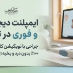 راهنمای کامل مراحل، مزایا و قیمت ایمپلنت دیجیتال و ایمپلنت فوری در تبریز سال ۱۴۰۵