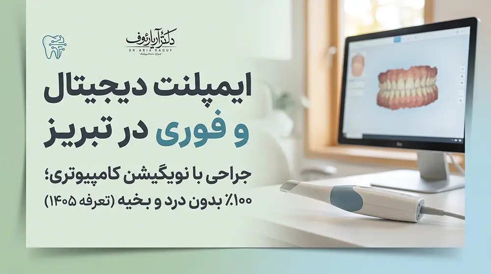 راهنمای کامل مراحل، مزایا و قیمت ایمپلنت دیجیتال و ایمپلنت فوری در تبریز سال ۱۴۰۵