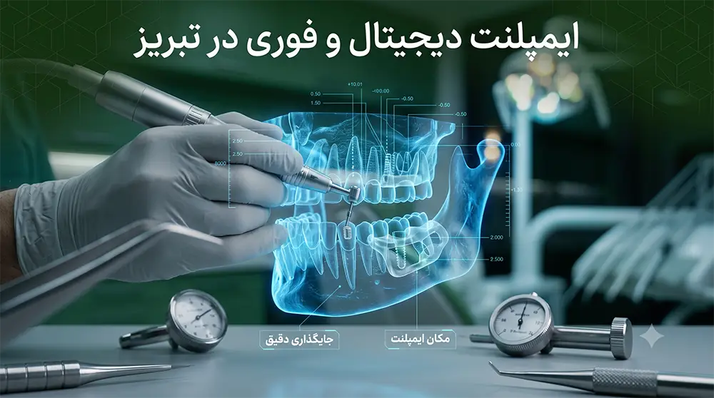 جراحی نویگیشن دندان و تکنیک ایمپلنت پانچی بدون برش لثه و درد در تبریز