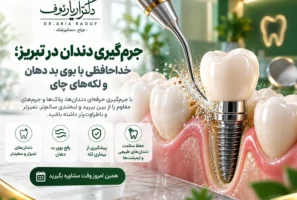 انجام جرم گیری دندان و بروساژ تخصصی در کلینیک دکتر رئوف تبریز