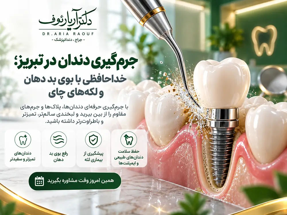 انجام جرم گیری دندان و بروساژ تخصصی در کلینیک دکتر رئوف تبریز