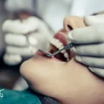 انجام جرم گیری دندان و بروساژ تخصصی در کلینیک دکتر رئوف تبریز