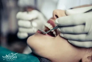 انجام جرم گیری دندان و بروساژ تخصصی در کلینیک دکتر رئوف تبریز