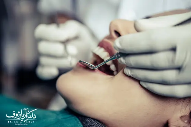 انجام جرم گیری دندان و بروساژ تخصصی در کلینیک دکتر رئوف تبریز