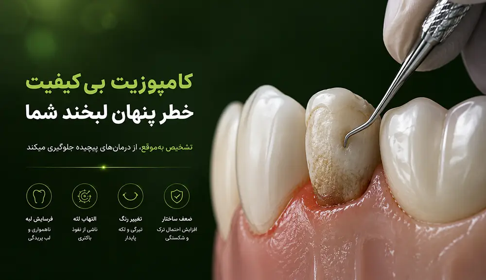 بررسی کامل عوارض کامپوزیت دندان و علت بوی بد دهان و پوسیدگی دندان زیرین ۱۴۰۵