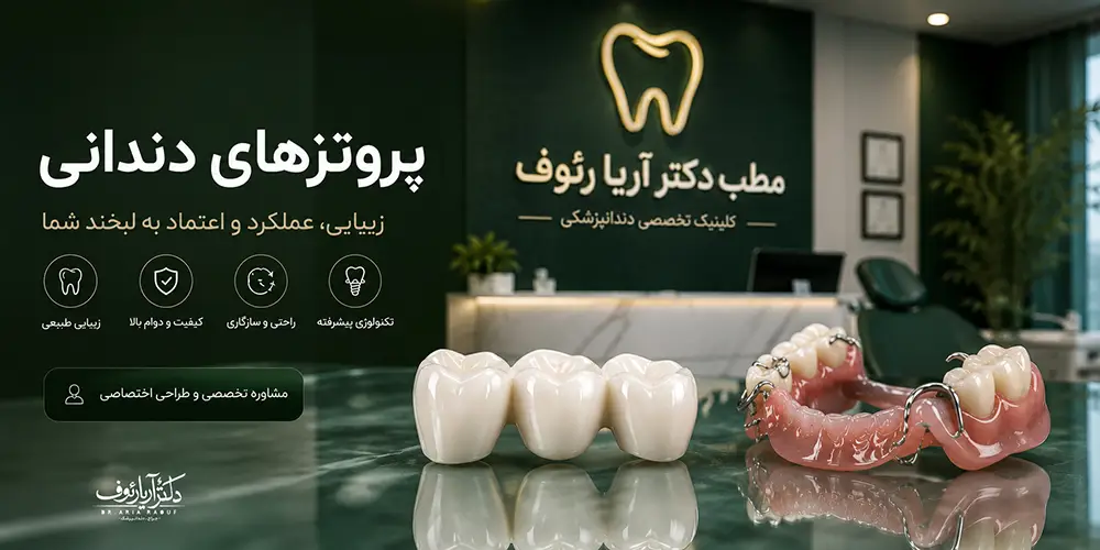 نمونه مدلهای آزمایشگاهی روکش تمام سرامیک و انواع پروتز دندان ثابت و متحرک