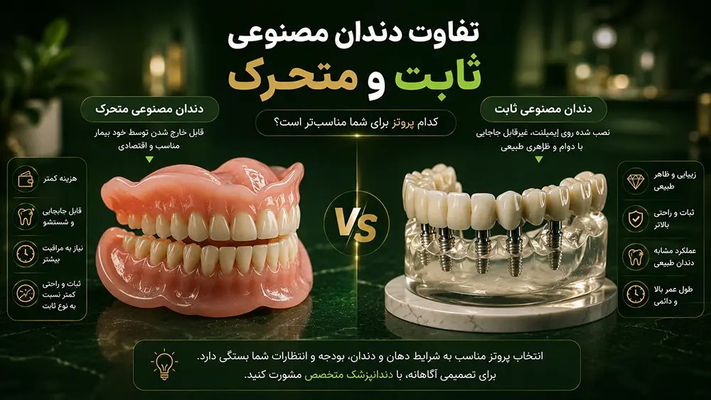 مقایسه و بررسی تفاوت دندان مصنوعی ثابت و متحرک و تعرفههای سال ۱۴۰۵