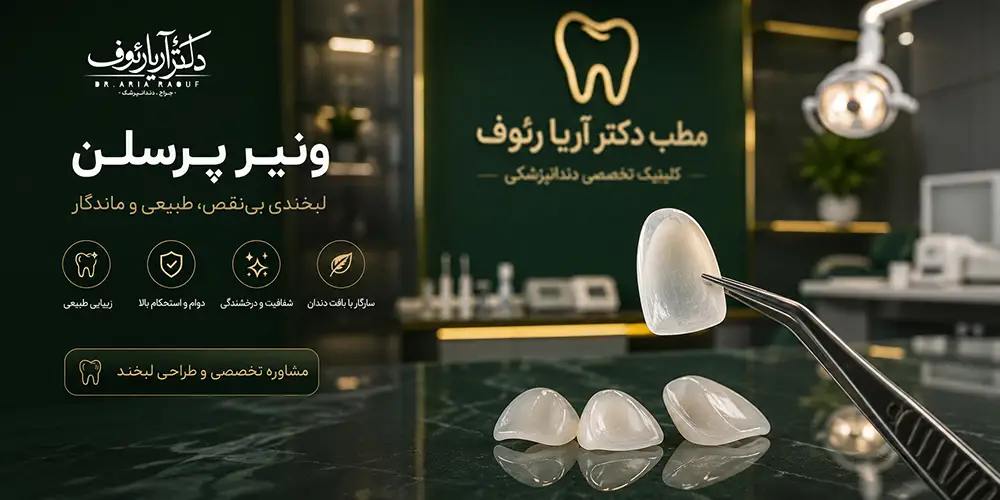 پوستههای ظریف پرسلن ونیر جهت ارائه خدمات لمینت سرامیکی لوکس در کلینیک دندانپزشکی زیبایی