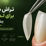 راهنمای جامع میزان تراش دندان برای لمینت و معرفی نسل جدید لمینتهای بدون تراش در تبریز سال ۱۴۰۵