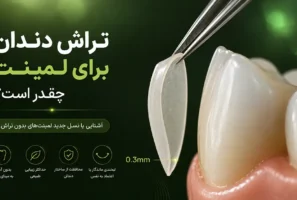 راهنمای جامع میزان تراش دندان برای لمینت و معرفی نسل جدید لمینت‌های بدون تراش در تبریز سال ۱۴۰۵