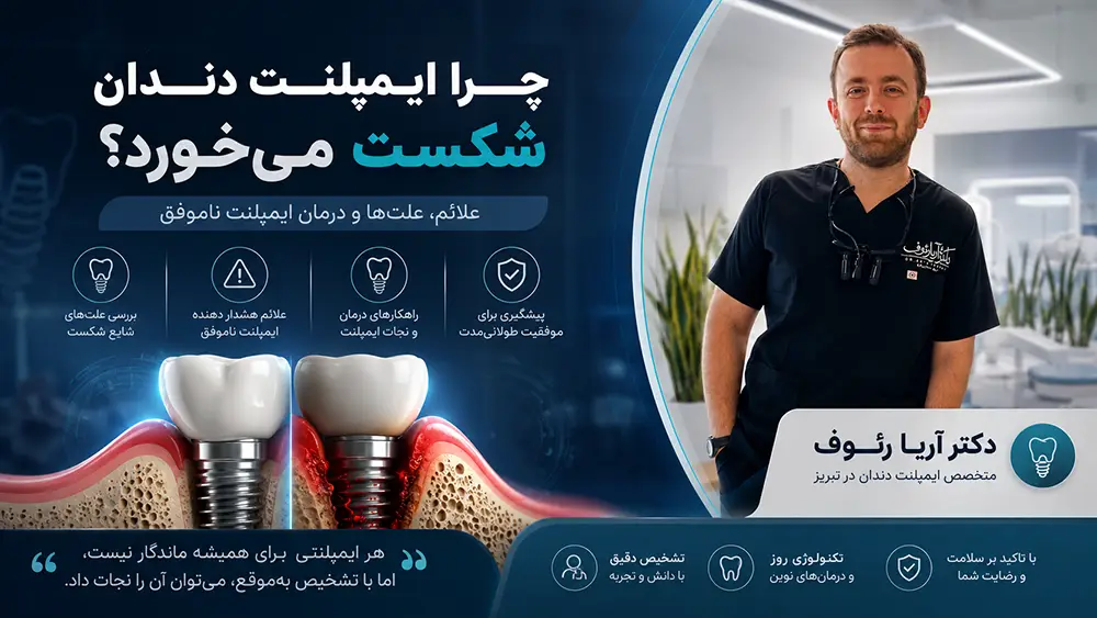 بررسی علت شکست ایمپلنت دندان و تحلیل استخوان فک