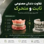 مقایسه و بررسی تفاوت دندان مصنوعی ثابت و متحرک و تعرفههای سال ۱۴۰۵