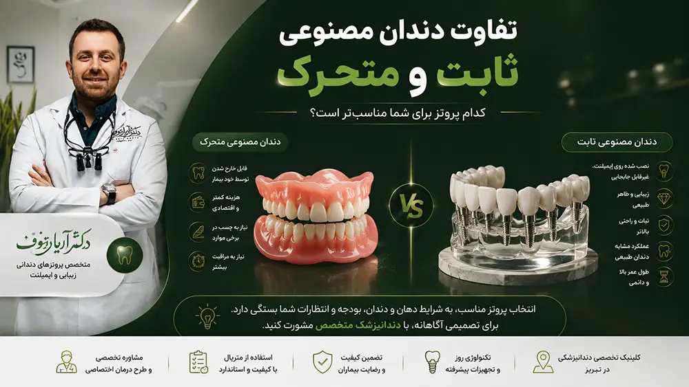 مقایسه و بررسی تفاوت دندان مصنوعی ثابت و متحرک و تعرفههای سال ۱۴۰۵