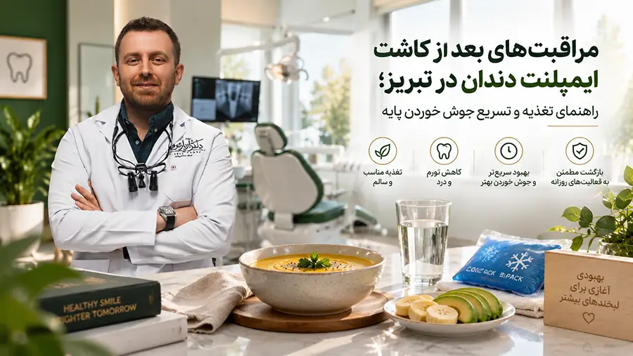 راهنمای مراقبت های بعد از ایمپلنت دندان و تغذیه سالم جهت تسریع جوش خوردن پایه در تبریز