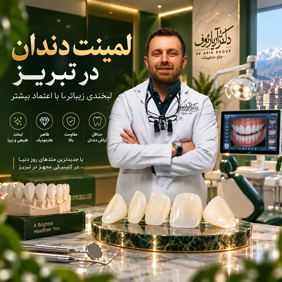 طراحی لبخند با لمینت سرامیکی در تبریز توسط دکتر آریا رئوف