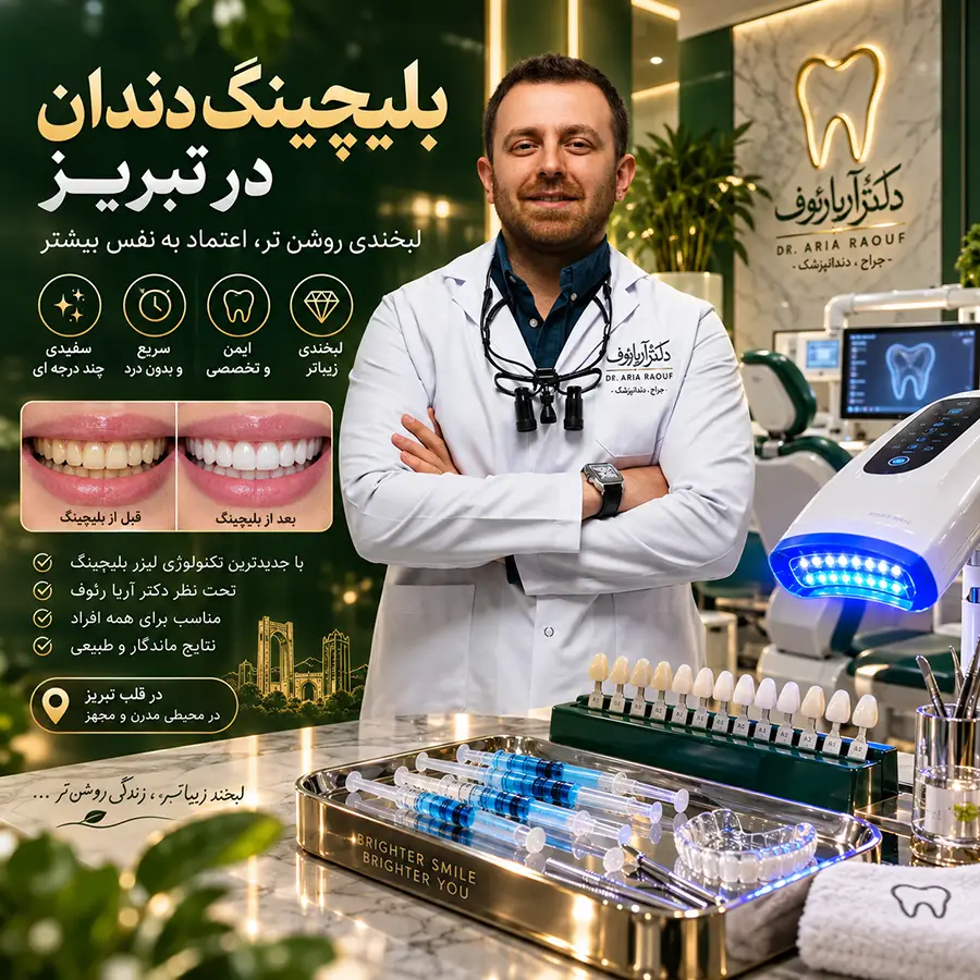 بلیچینگ و سفید کردن دندان در تبریز توسط دکتر آریا رئوف
