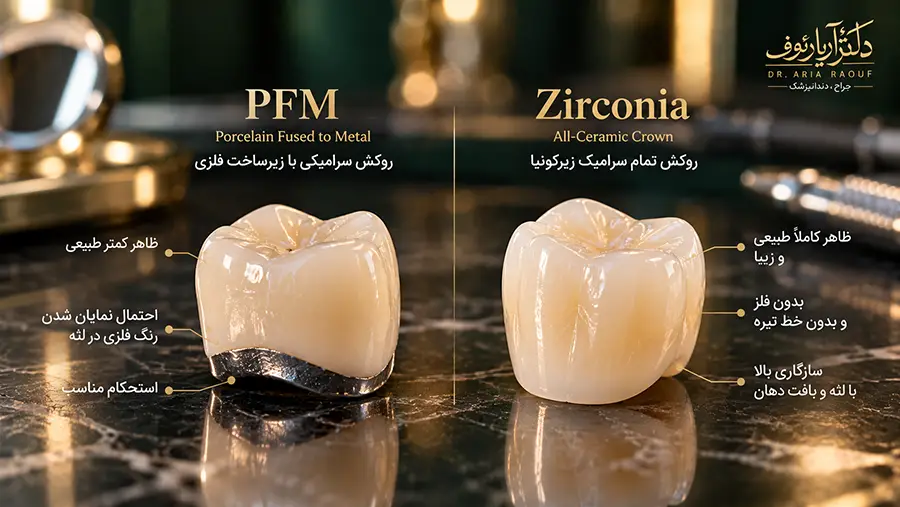مقایسه روکش دندان تمام سرامیک زیرکونیا با روکش فلزی سرامیکی PFM در کلینیک دکتر آریا رئوف