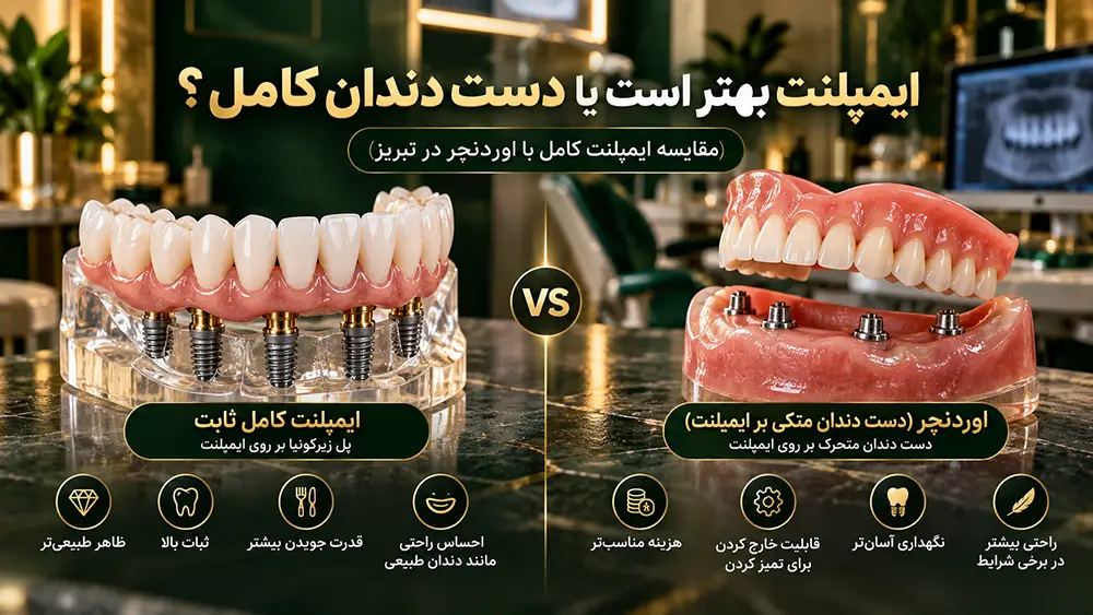 ماکت مقایسه ایمپلنت کامل ثابت با دست دندان اوردنچر بر پایه ایمپلنت در کلینیک دندانپزشکی در تبریز